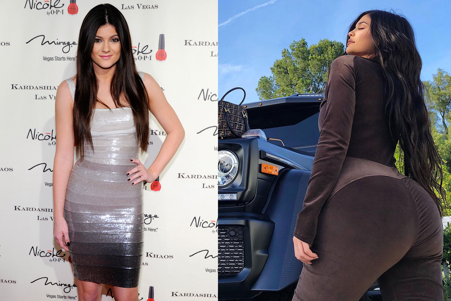 Jenner before surgery kylie butt byqifyp 86.